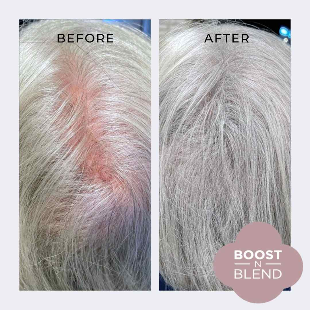 before and after boost n blend showing hair loss on the top of the head - grey hair