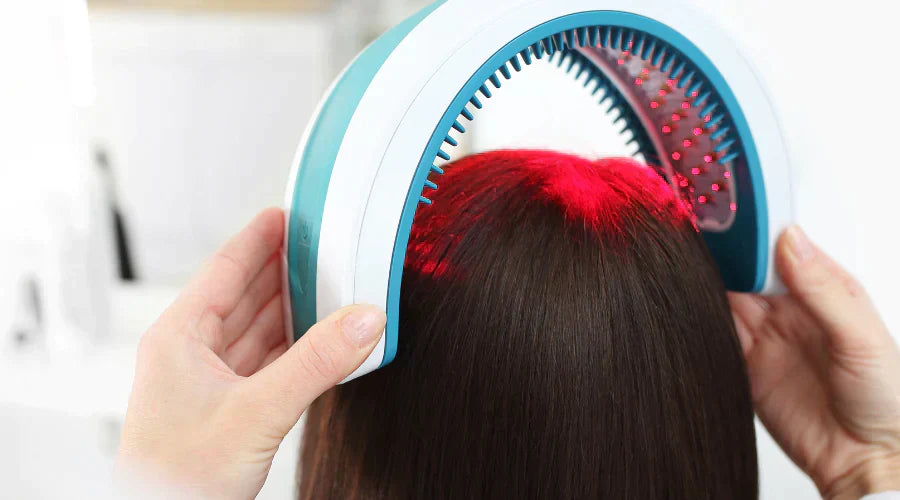 Laser therapy for female hair loss
