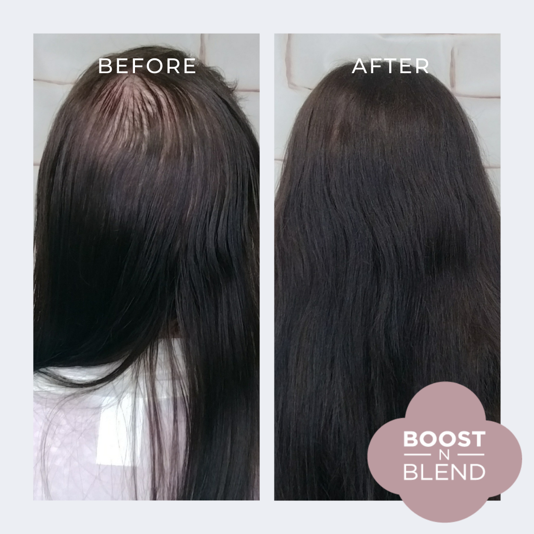 Before and after boost n blend showing hair loss on the crown