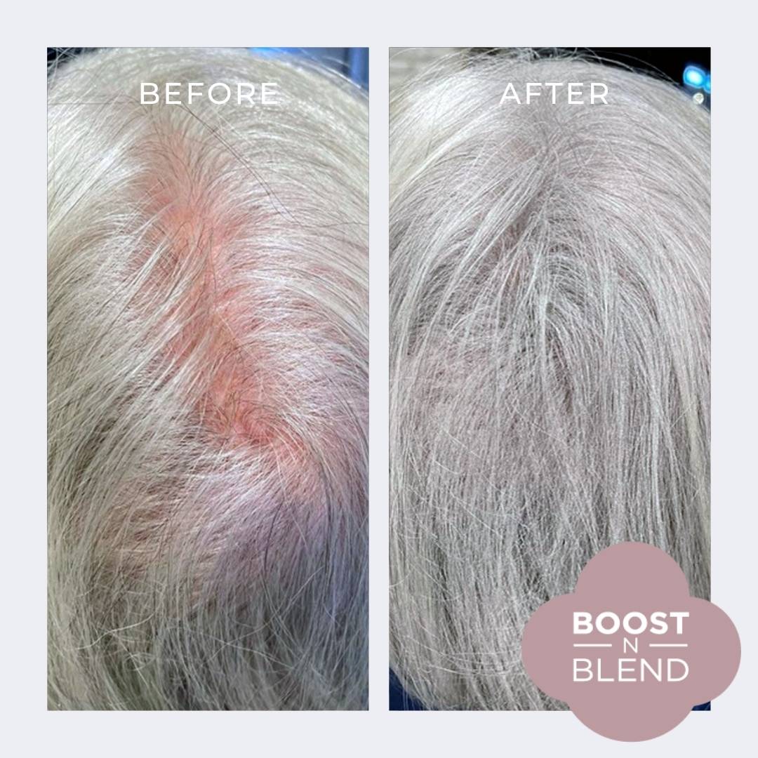 Light Grey Hair Fibres Before and After